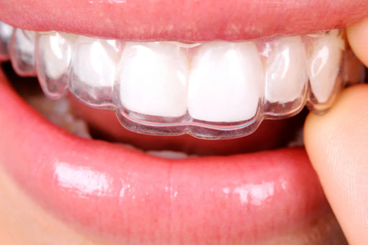 16 Dental White Clinic clinic photo 2