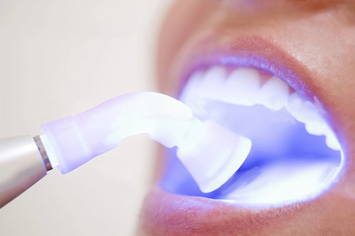 16 Dental White Clinic clinic photo 4