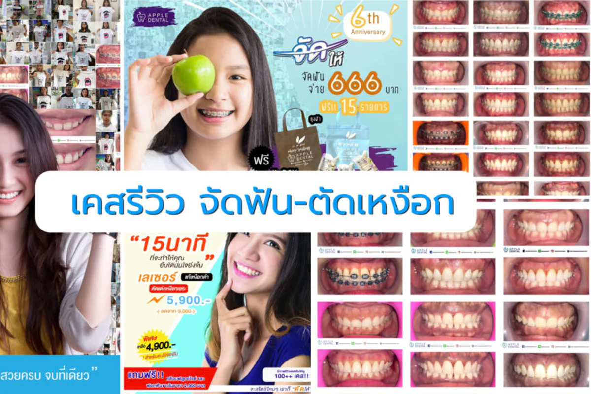 Apple Dental จัดฟัน ตัดเหงือก - สาขาด่านสำโรง clinic photo 4