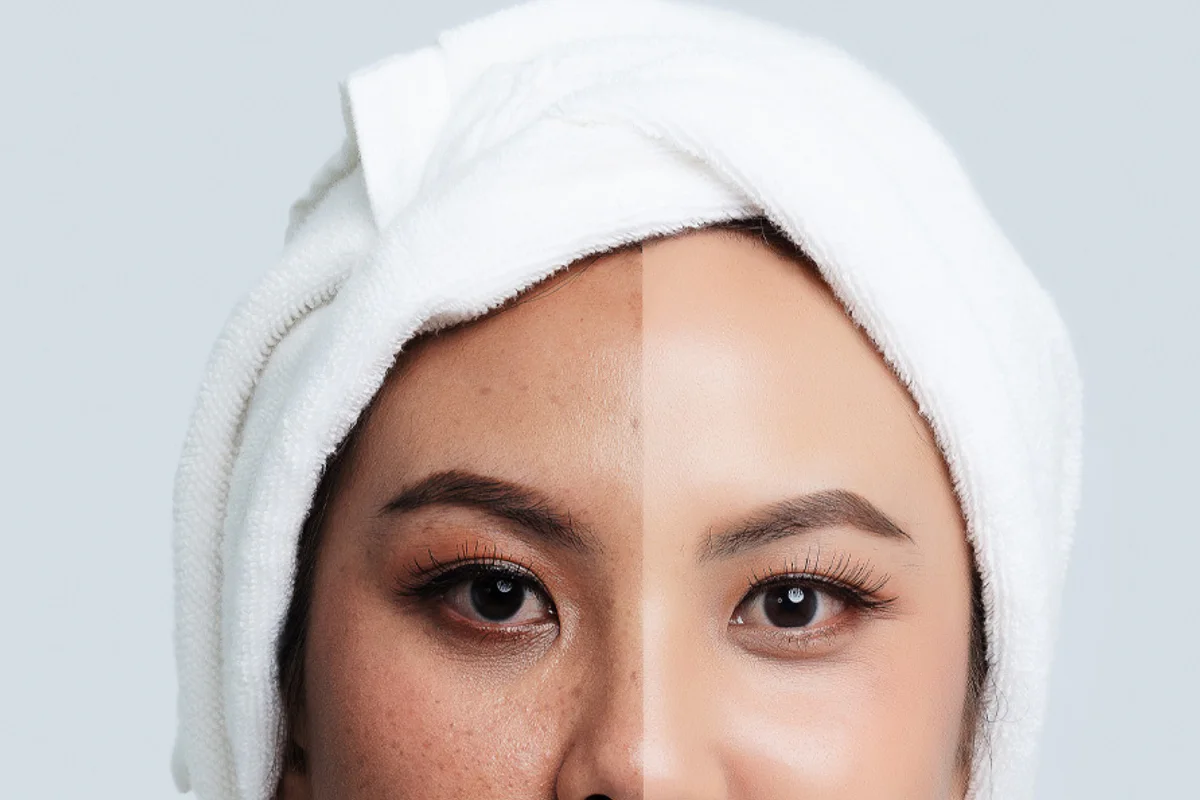 Katu Dermatology คลินิกผิวหนังกะทู้ ศูนย์เลเซอร์และความงามภูเก็ต clinic photo 2