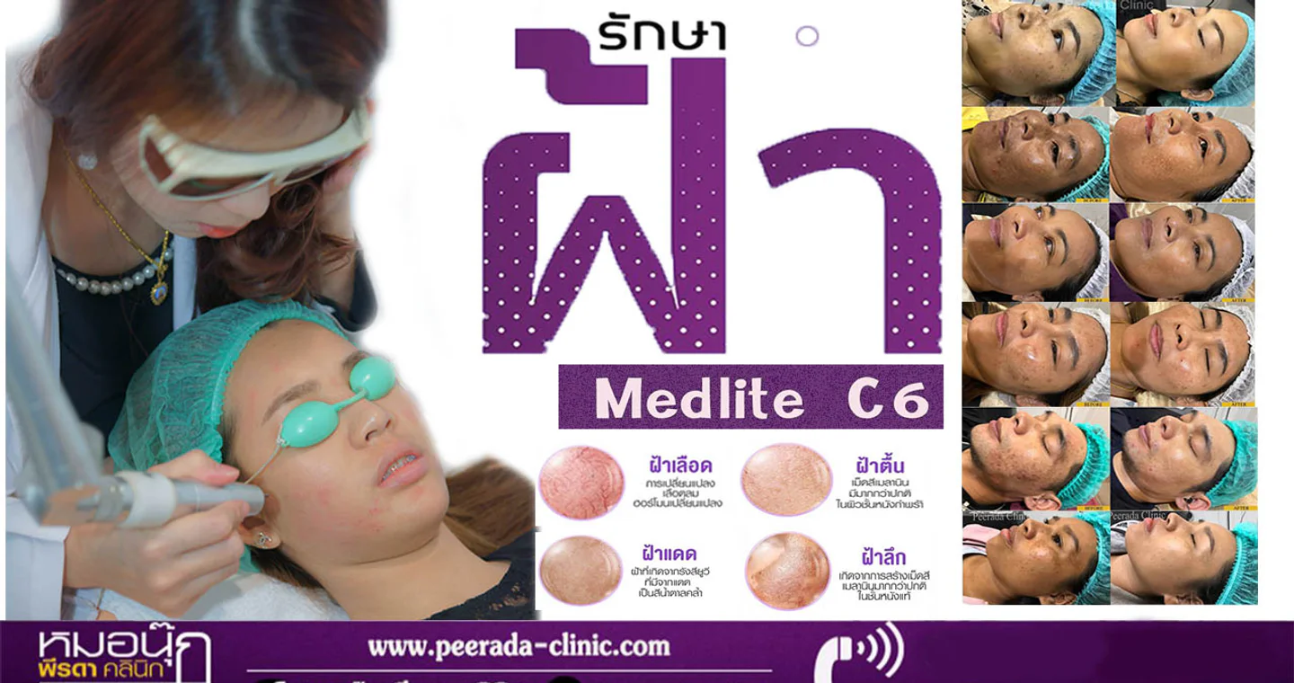 รักษาฝ้าหมอนุ๊ก พีรดาคลินิก clinic cover