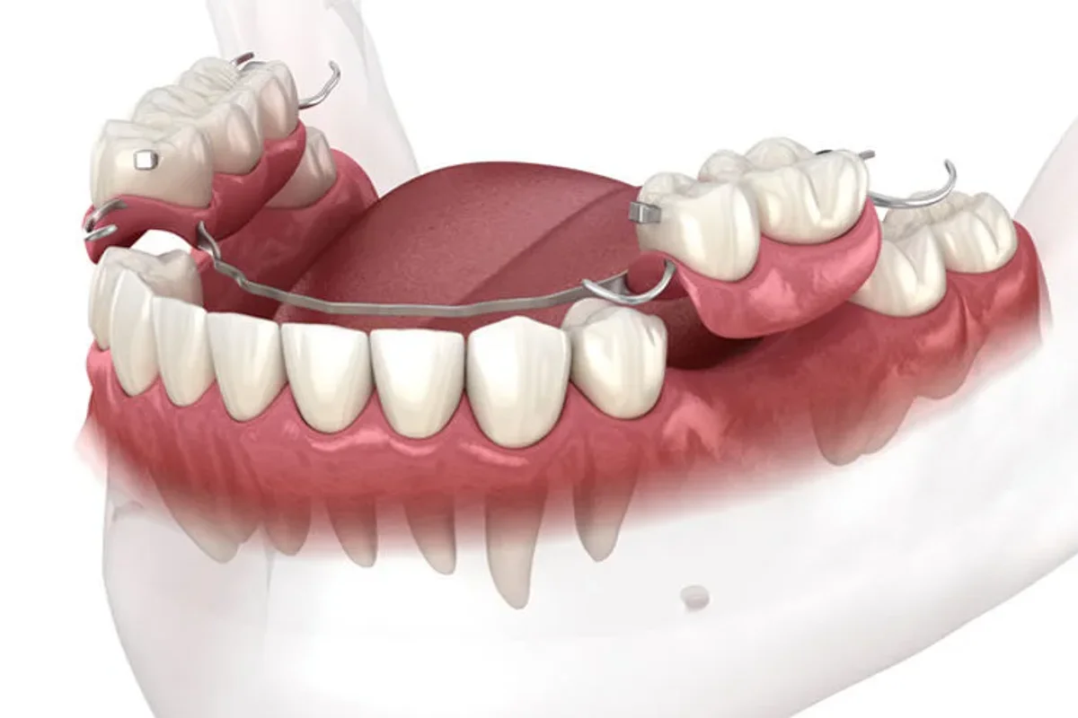 Srisuk Dental Care clinic photo 5
