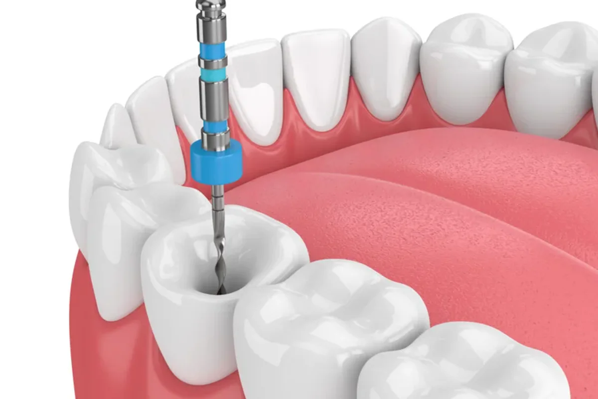 Srisuk Dental Care clinic photo 4