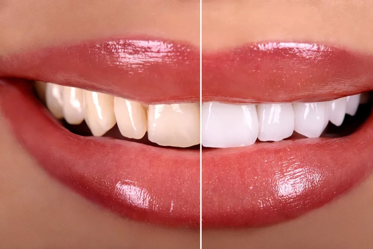 Srisuk Dental Care clinic photo 3