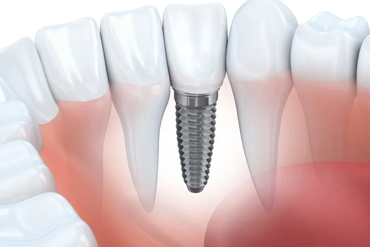 Srisuk Dental Care clinic photo 2