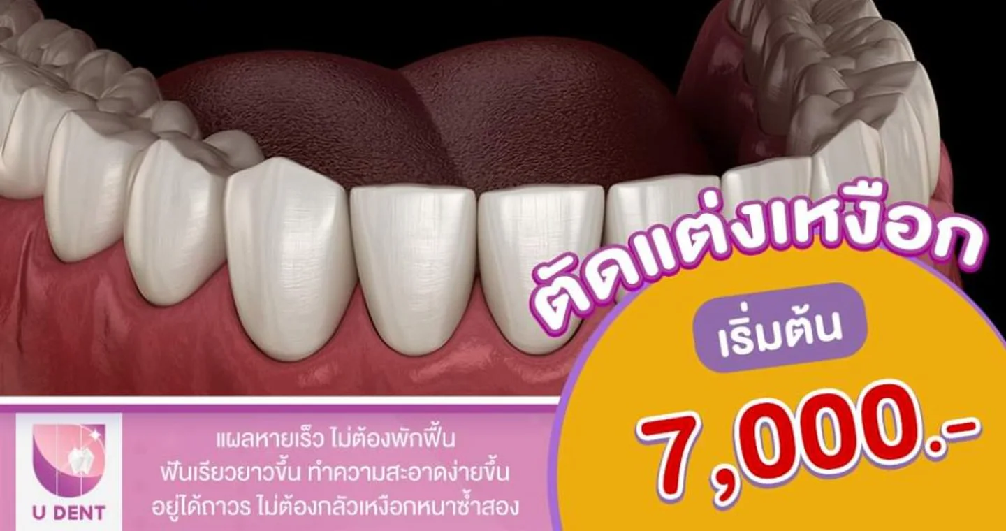 U Dent ยูเด้นท์คลินิกทันตกรรม clinic cover